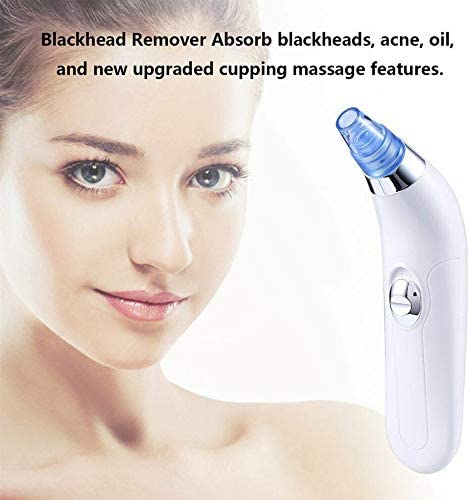 Blackhead Remover – Deep Pore Cleansing Tool