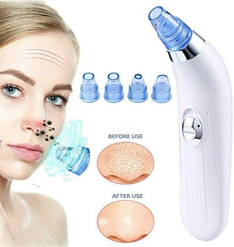 Blackhead Remover – Deep Pore Cleansing Tool