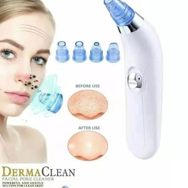 Blackhead Remover – Deep Pore Cleansing Tool